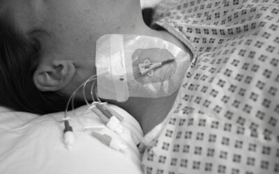 Ensuring Therapeutic Maintenance in Critical Care: Choosing the Right Number of Lumens in Vascular Access