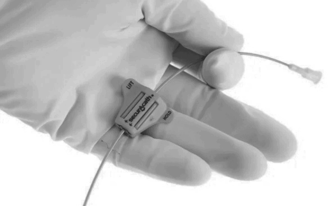 7 Key Benefits of Subcutaneous Anchor Securement Systems (SASS) for PICCs
