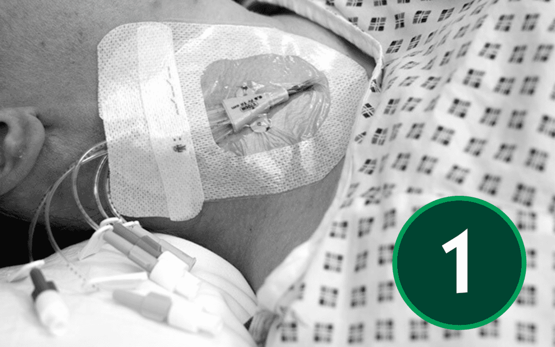 Article 1: Understanding CVCs: Roles, Anatomy, and Device Selection