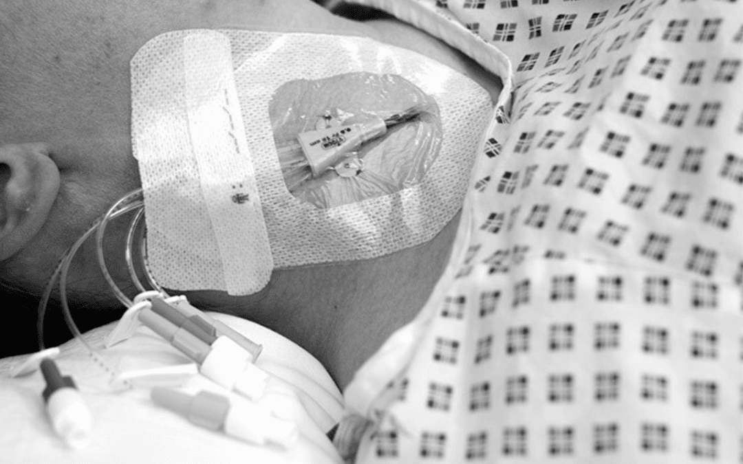 Navigating CVCs: An Informative Refresher