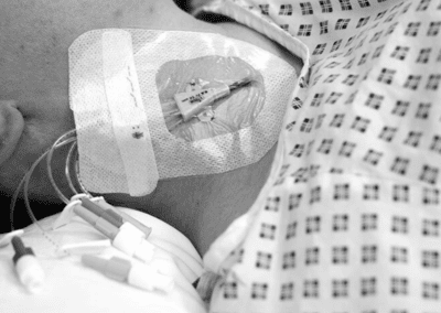 Navigating CVCs: An Informative Refresher