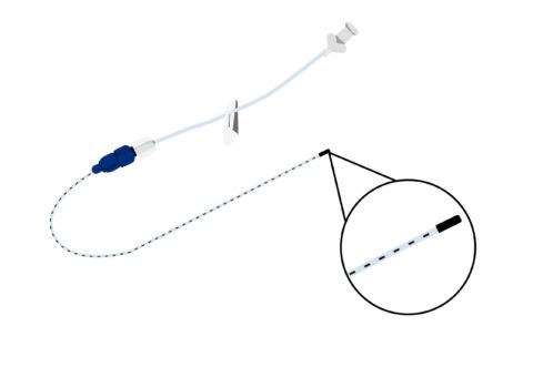 Can Neonatal PICCs Be Cut to Length? A Review of Risks, Evidence, and ...