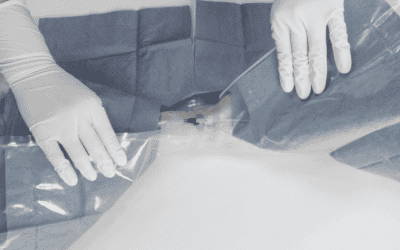 Why Use a Procedure Pack For Arterial Catheter Placement?