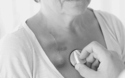 Huber Needles in Clinical Practice: Insertion, Removal and Best Practice