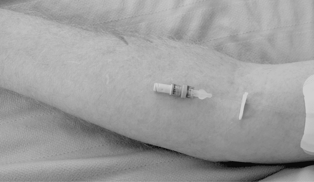 Overcoming Catheter Occlusion: Why TKO Remains a Reliable Approach to Maintaining Patency