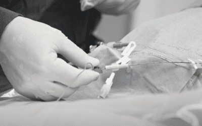 ECG-Guided Central Venous Catheter Placement: Advancing Accuracy and Efficiency at the Bedside
