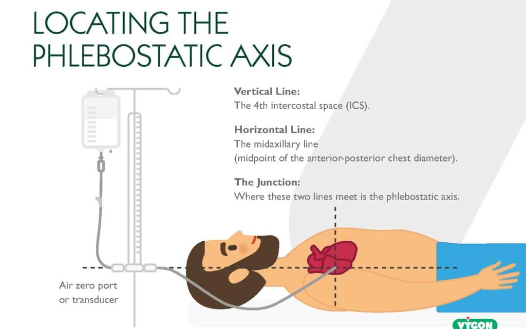 Locating The Phlebostatic Axis