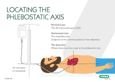 Locating The Phlebostatic Axis