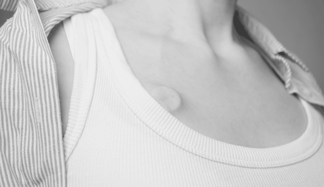 Seesite® in Clinical Practice: Innovation, Safety and Performance in Implantable Ports