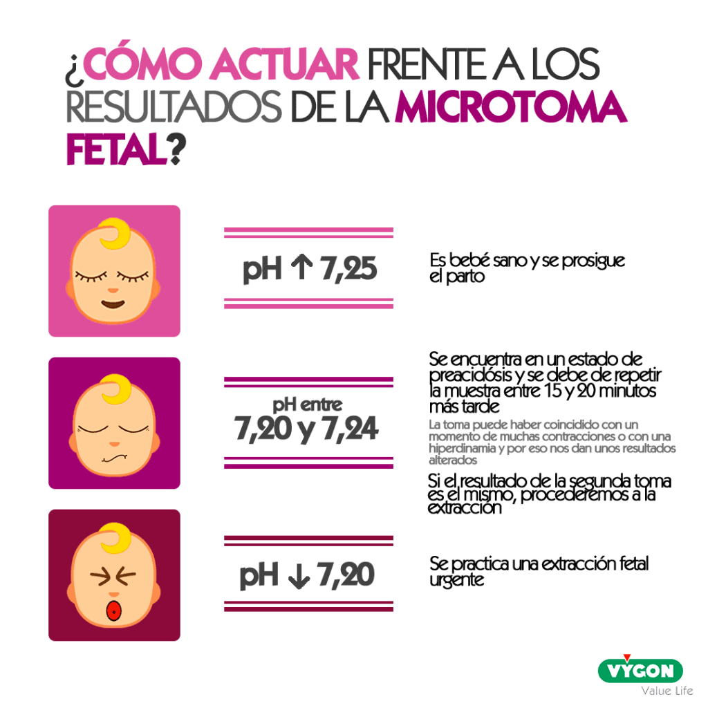 La Microtoma Fetal, Determinar El Bienestar Del Bebé En El Parto