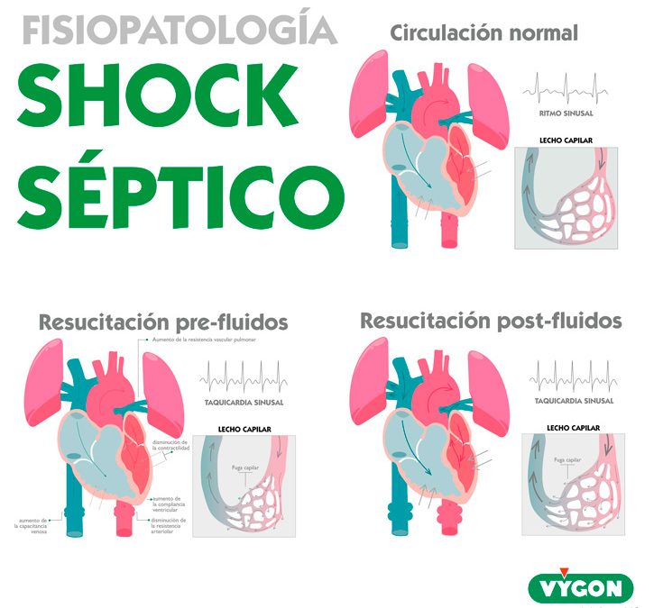 Fisiopatología shock séptico