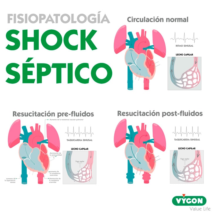 Fisiopatología-shock-séptico