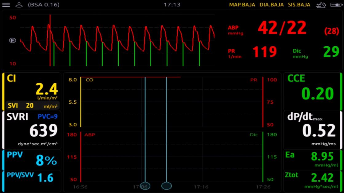 monitorización neonatología
