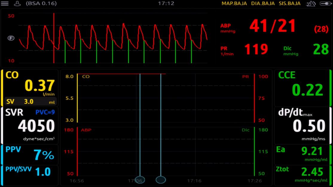 monitorización neonatología no indexados