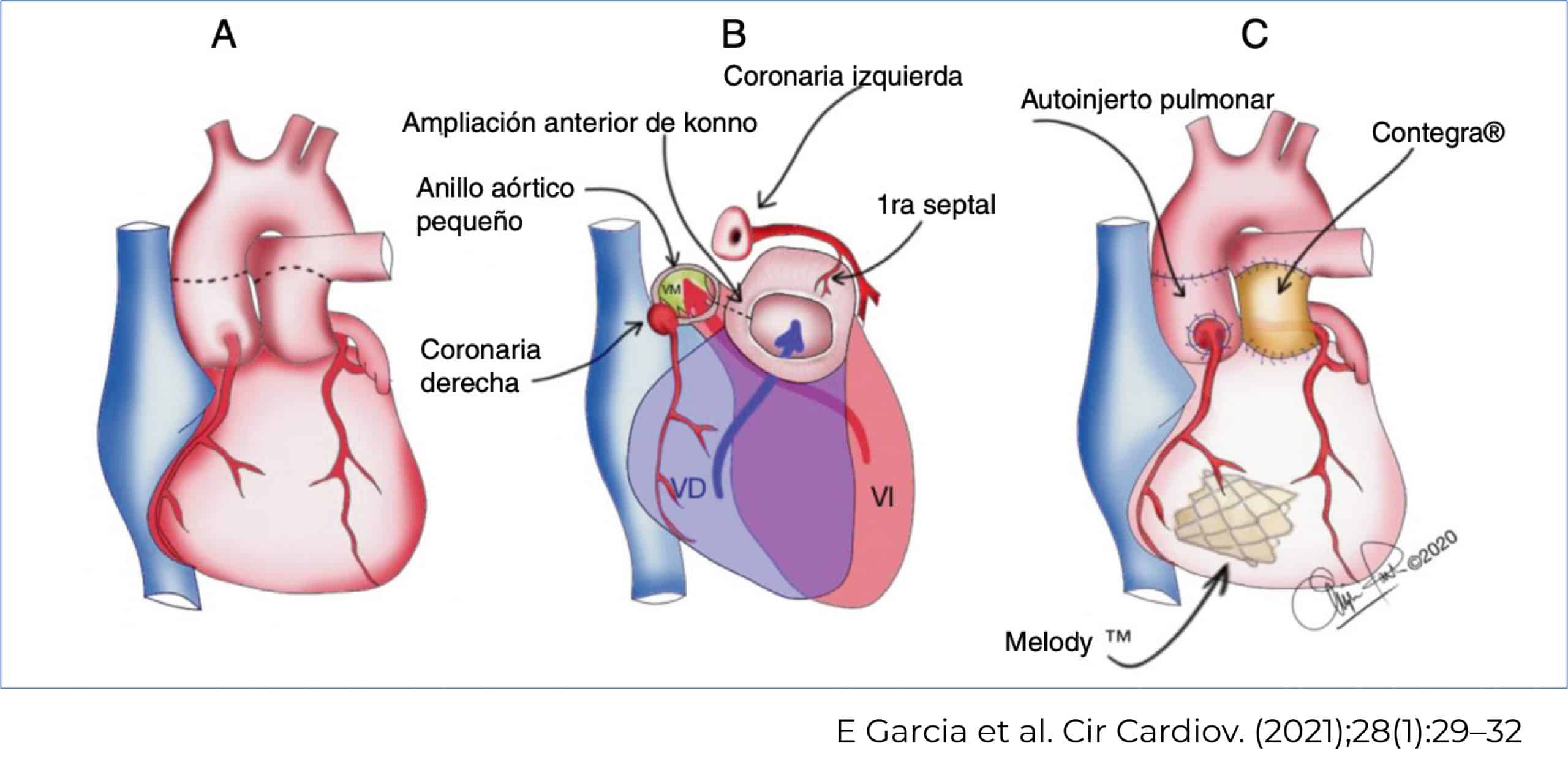 postoperatorio cx cardiaca ped