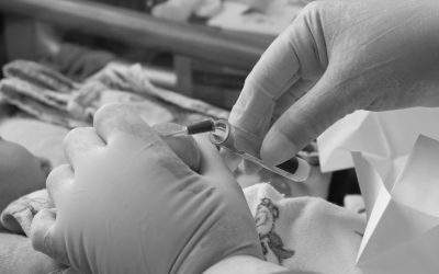 Métodos para la extracción de muestras de sangre en neonatos