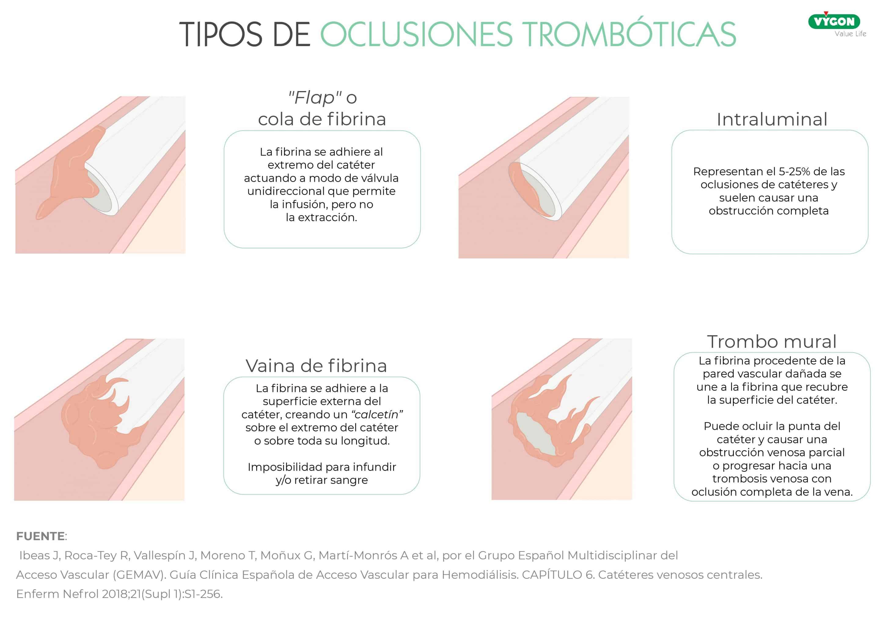 oclusiones trombóticas