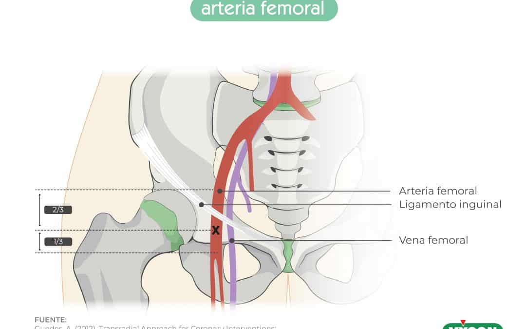 Puntos de referencia arteria femoral