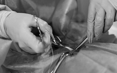 3 Motivos por los que dejar de suturar un acceso vascular