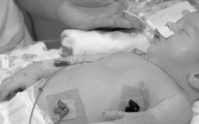 ¿Qué venas están disponibles en la colocación del PICC en neonatos?