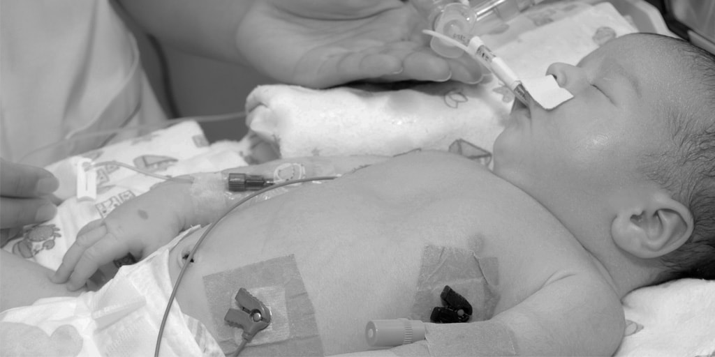 Qué venas están disponibles en la colocación del PICC en neonatos