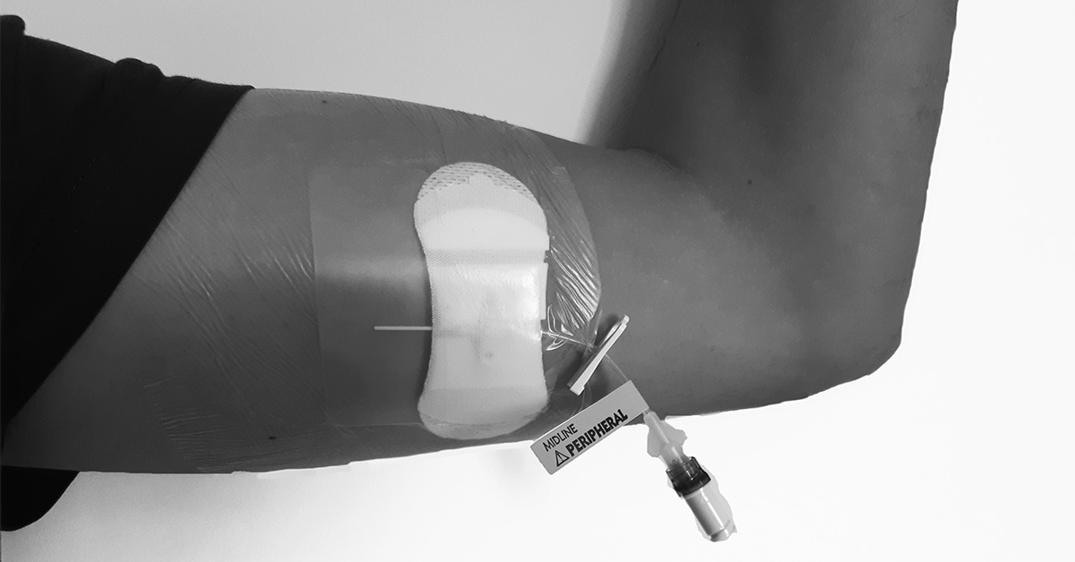 Midline catheter placement and maintenance protocol Campus Vygon