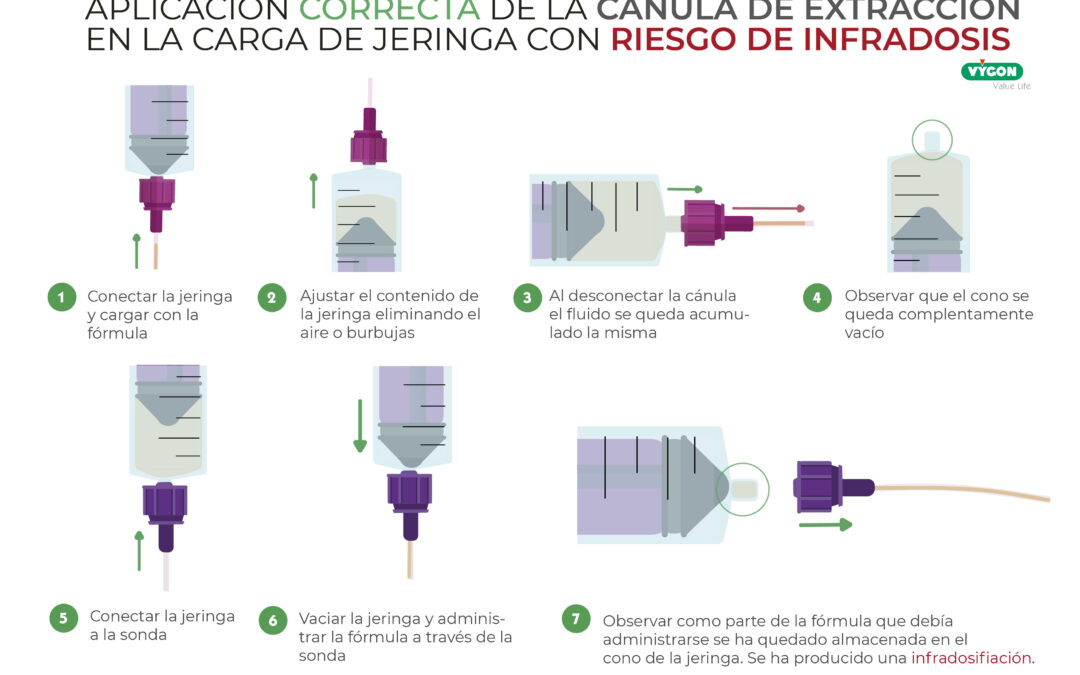 Aplicación correcta de la cánula de extracción en la carga de jeringa con riesgo de infradosis