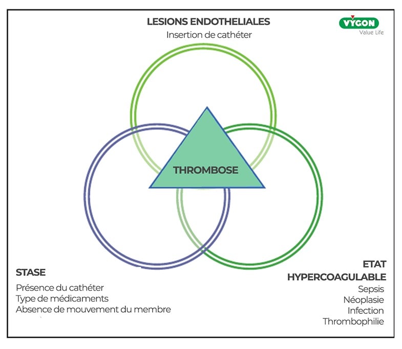 Causes-de-thrombose-liée-au-cathéter