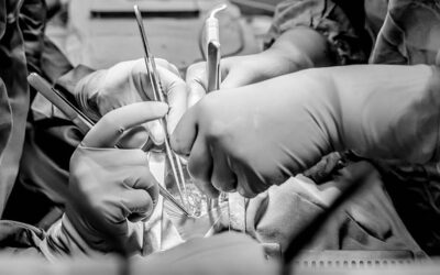 Monitorización hemodinámica en la cirugía de aorta ascendente y arco aórtico