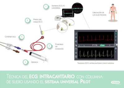 Montaje del sistema ECG universal