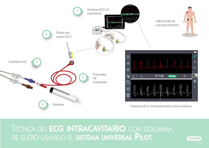 Montaje del sistema ECG universal