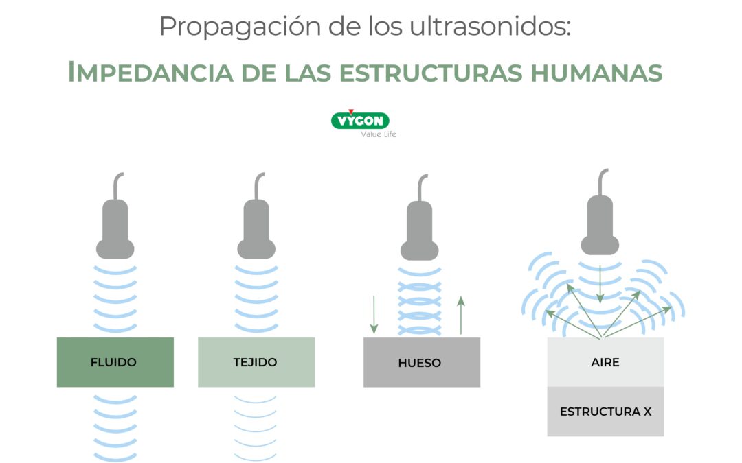 Propagación de los ultrasonidos – Impedancia de las estructuras humanas