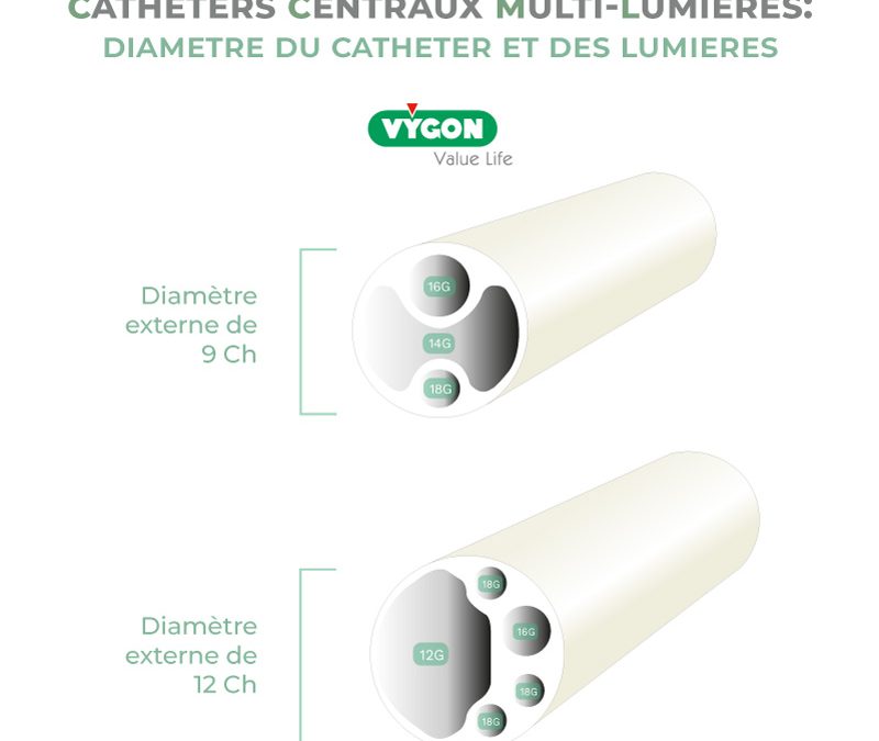 Cathéters centraux multi-lumières : diamètre du cathéter et des lumières