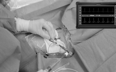 El sistema ECG universal: comprobación rápida y segura del acceso vascular central