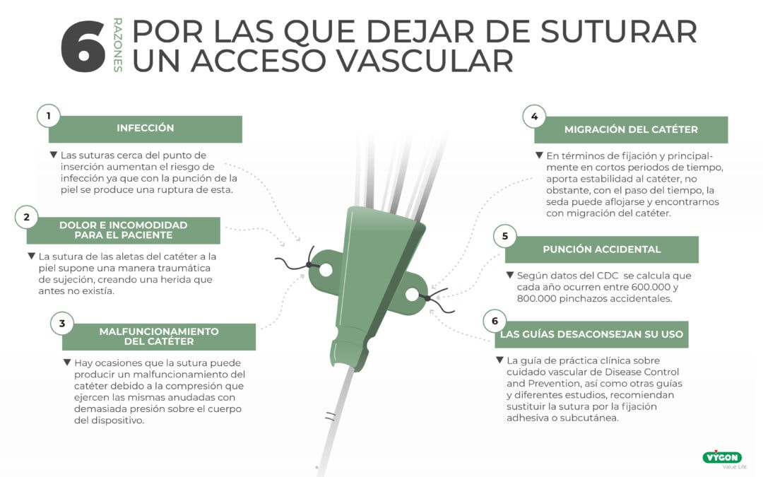 6 Razones por las que dejar de suturar un acceso vascular
