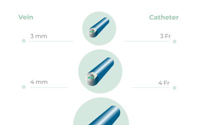 Catheter to vein ratio: choice of the right catheter diameter