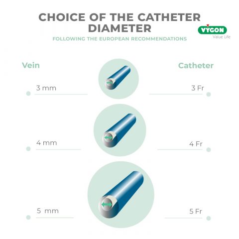 Catheter to vein ratio: What are the recommendations? - Campus Vygon