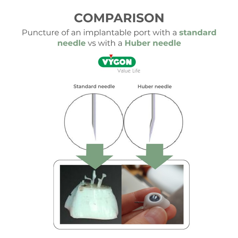 Puncture-of-an-implantable-port-with-a-standard-needle-vs-with-a-Huber-needle