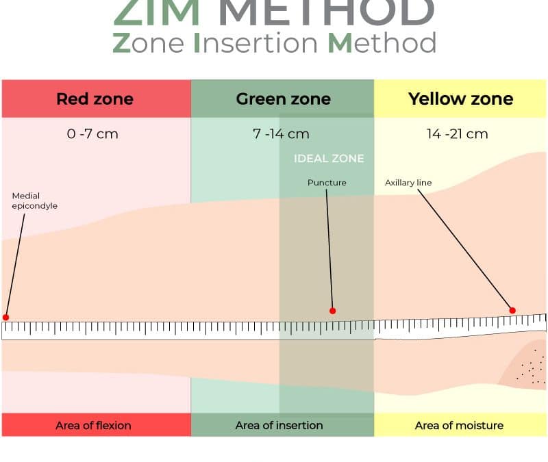 ZIM Method