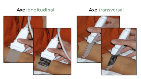Axe-longitudinal-axe-transversal