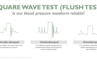 Square wave test (Flush Test)