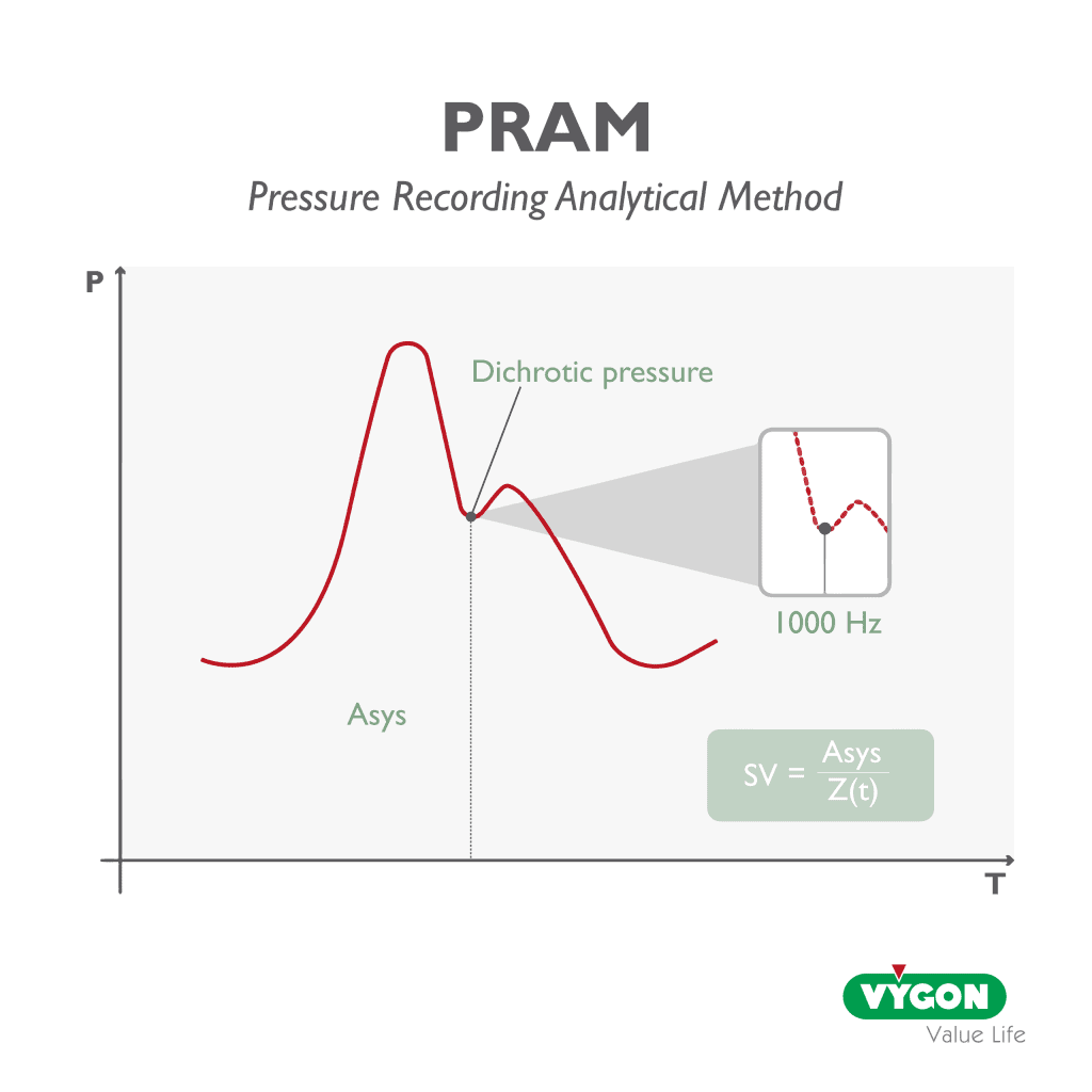 Infographic about the pressure reccording analytical method