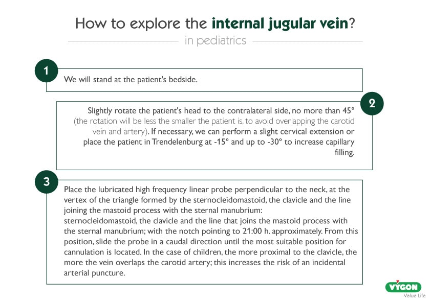 explore-internal-jugular-vein