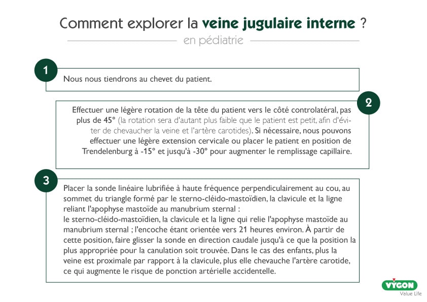 explorer-veine-jugulaire-interne