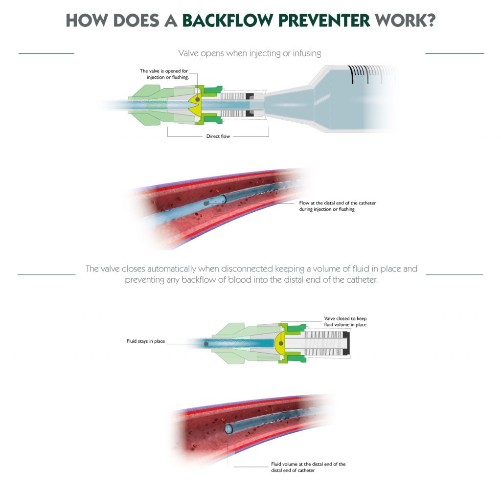 how-backflow-preventer-works